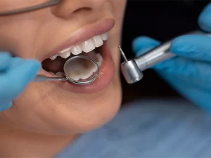 canabidiol na odontologia avancos no uso regenerativo e anti inflamatorio