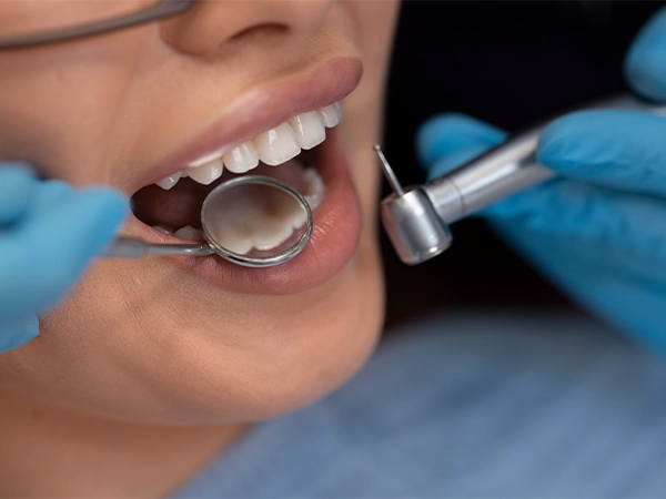 canabidiol na odontologia avancos no uso regenerativo e anti inflamatorio