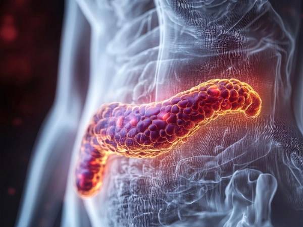 Cannabis medicinal no manejo da dor em pacientes com pancreatite crônica