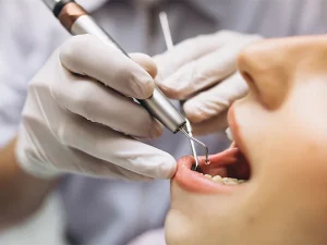 Potencial da Cannabis Medicinal em doenças periodontais